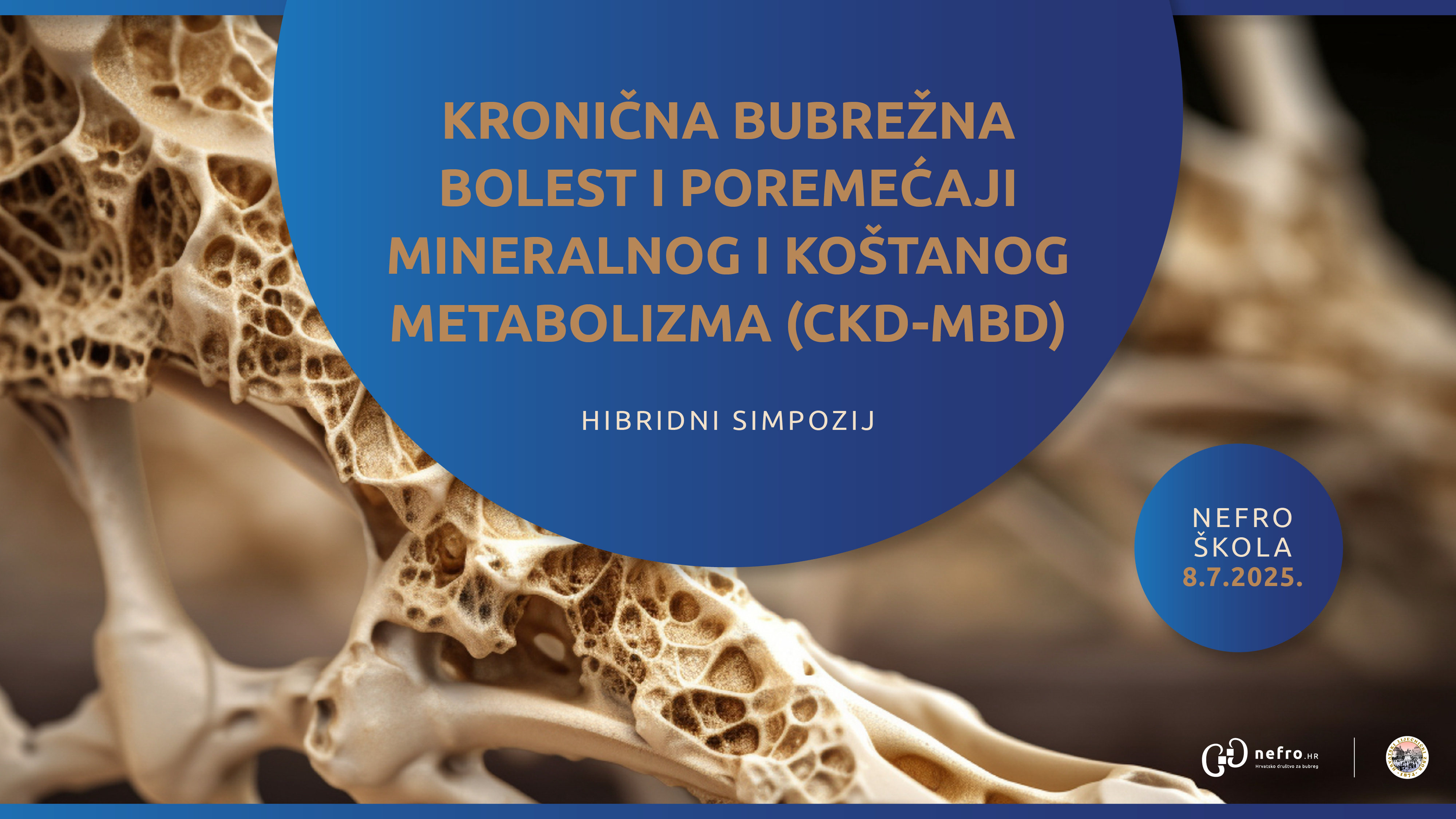 PARATIREOIDEKTOMIJA - KADA, KOME I ZAŠTO?